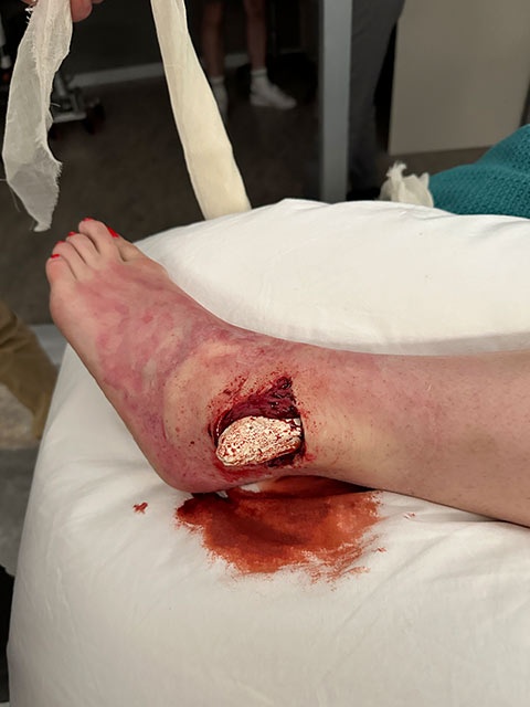 ankle
