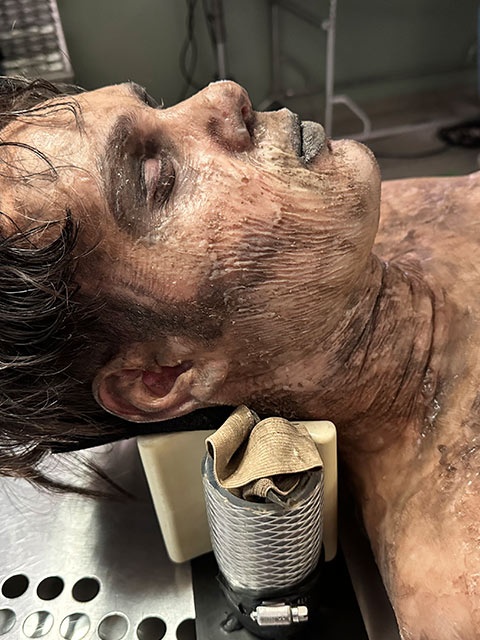 deadguy
