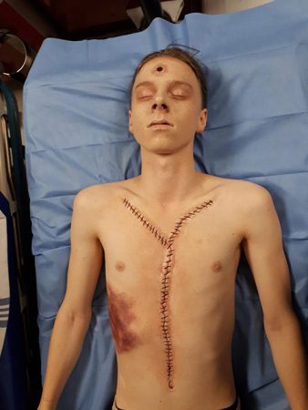 Autopsy - Cardinal S3